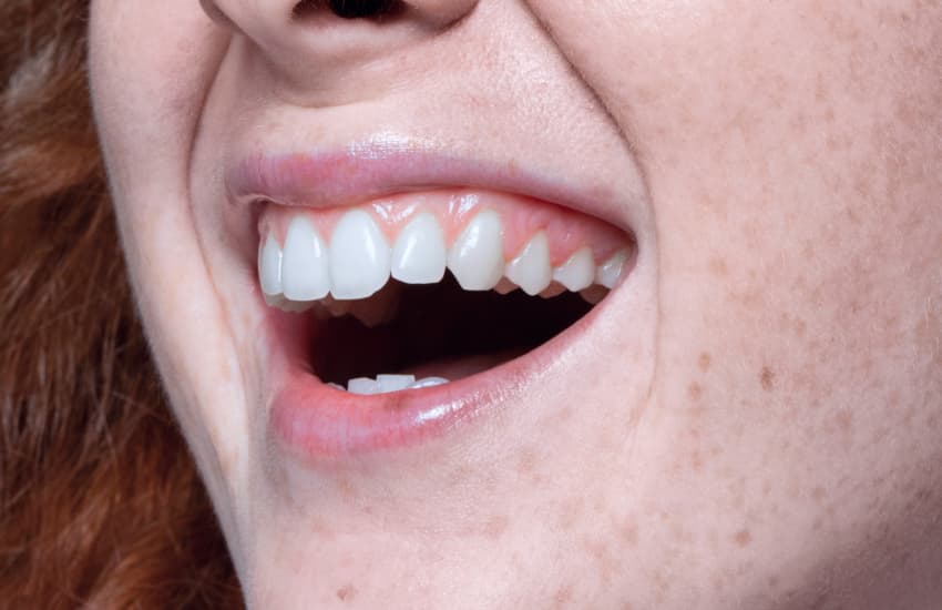 Wisdom Tooth Extractions in Fulton, NY - Fulton Dental Health