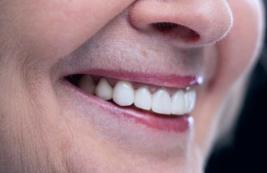 Dental Bridges in Fulton, NY - Fulton Dental Health